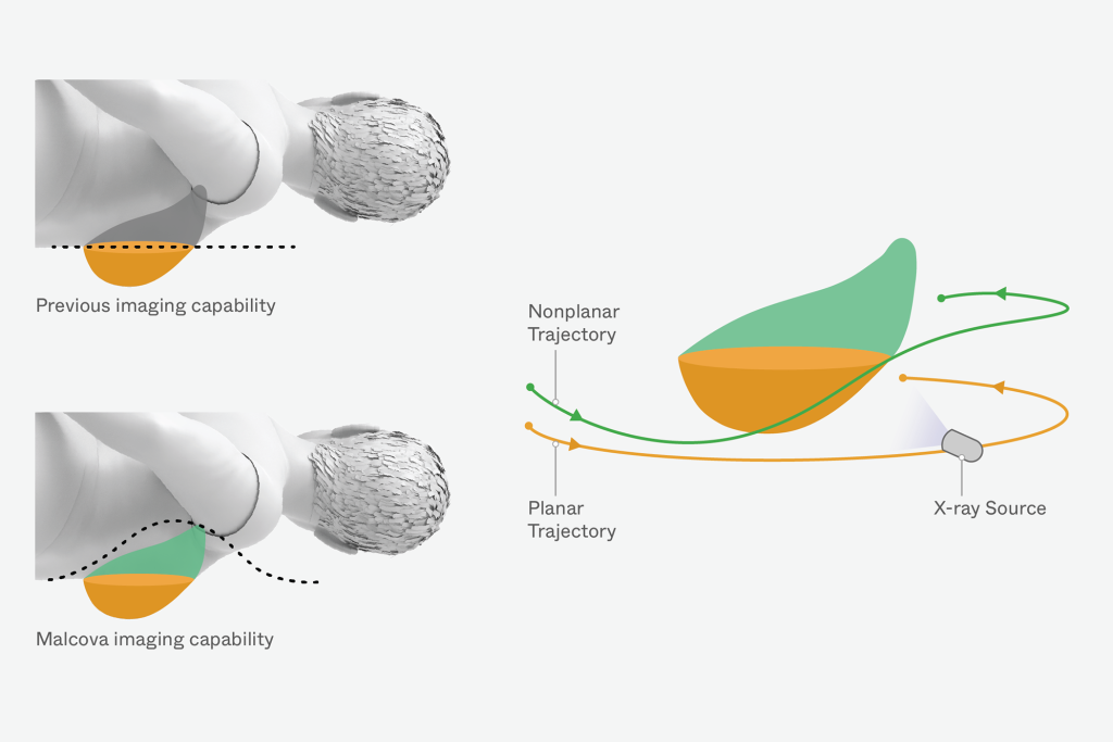 Diagram comparing previous breast imaging capability with Malcova's improved breast imaging capability which captures previously missed breast tissue, highlighting the difference in trajectories around a nonplanar object with an x-ray source.