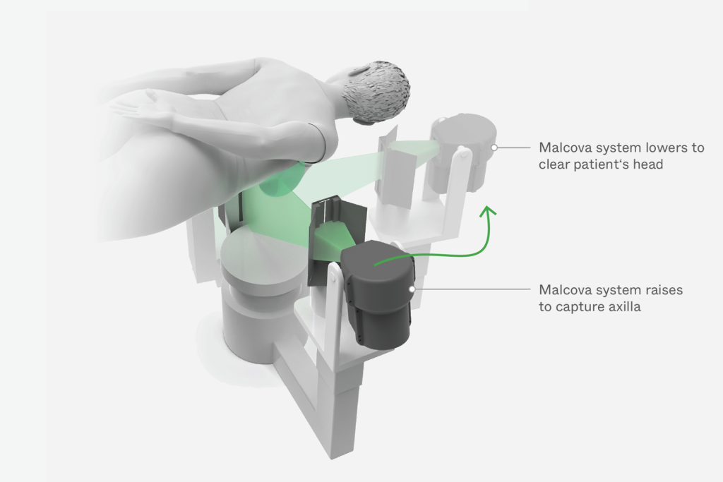 Illustration of Malcova's innovative breast imaging device adjusting height for patient comfort during a procedure.