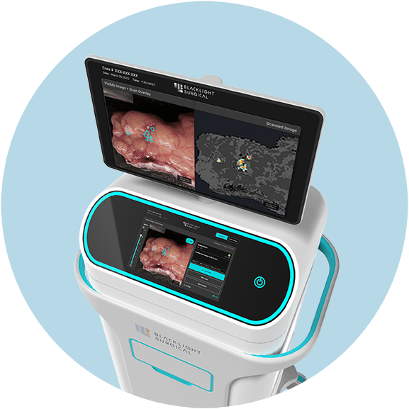 Utilizing cutting-edge triple ring technologies, the medical imaging device showcases two screens with detailed anatomical images and precise analysis.