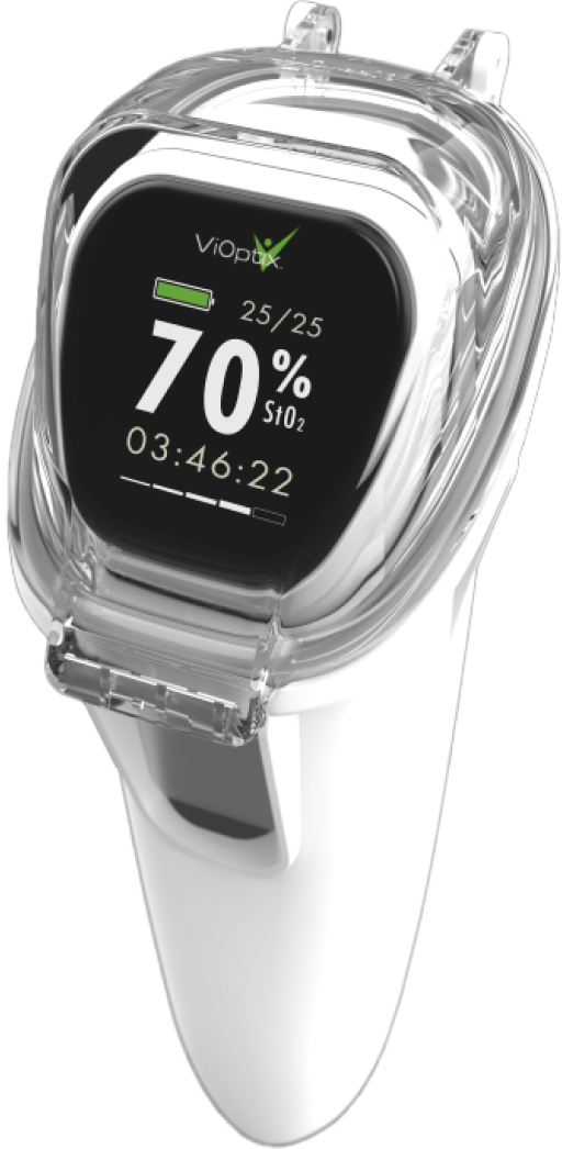 A medical device displaying 70% SpO2, with readings of 25/25 and 03:46:22, labeled with the brand name ViOptix.